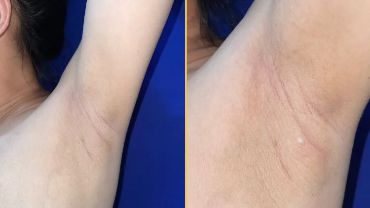 被遗忘的演化印记:副乳,人体发育的奇妙回响
